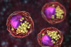Cholesterol LDL